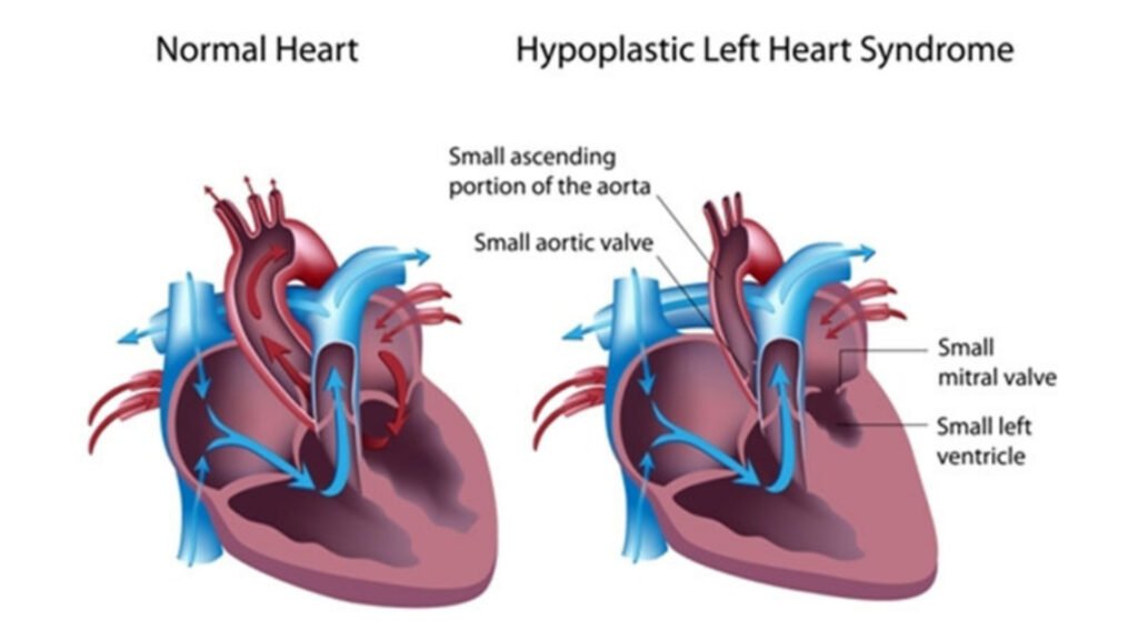 ASD Tedavisinde Cerrahi Yöntemlerle Müdahale Nasıl Gerçekleşir